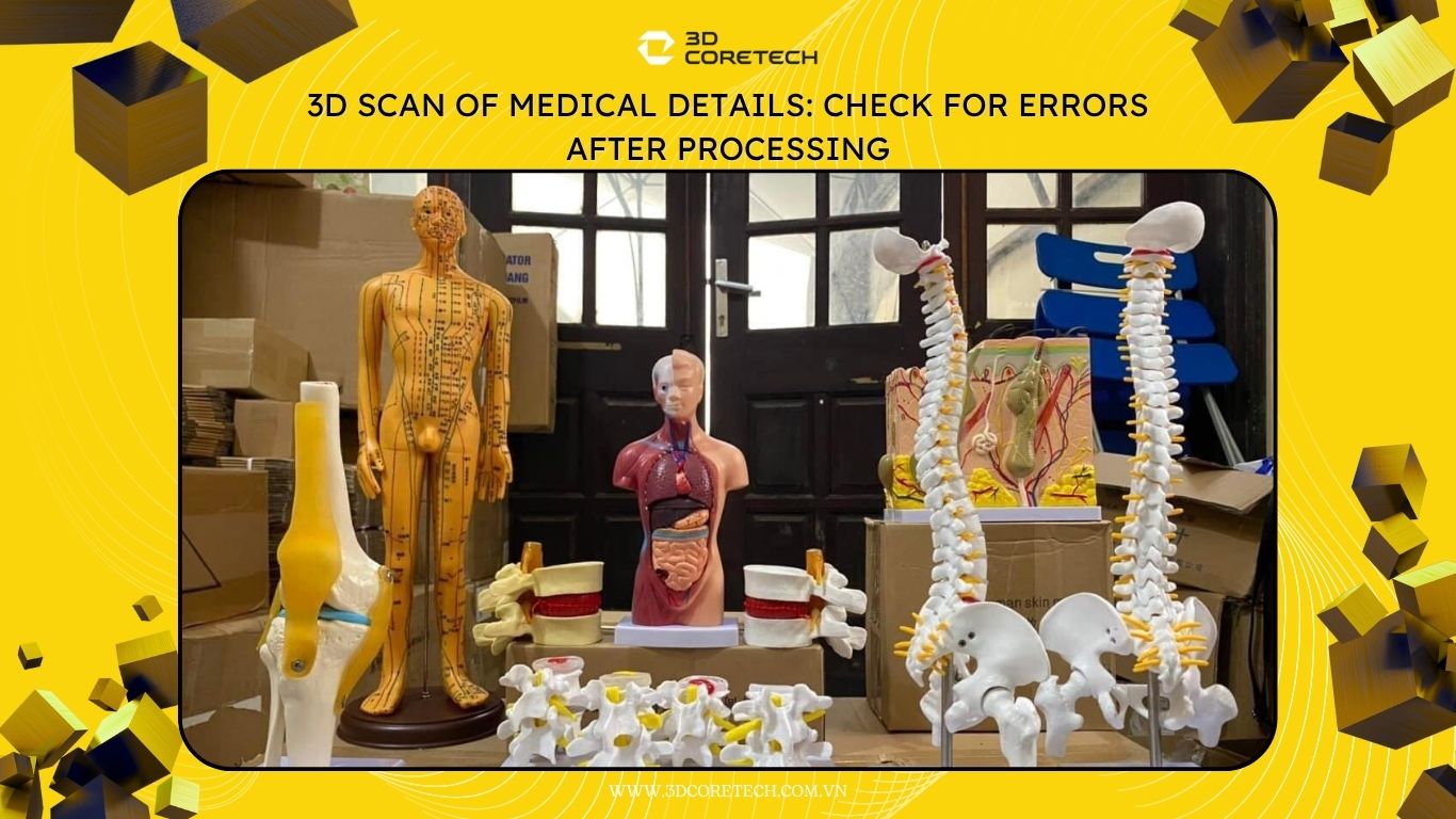 Scan 3D chi tiết y tế
