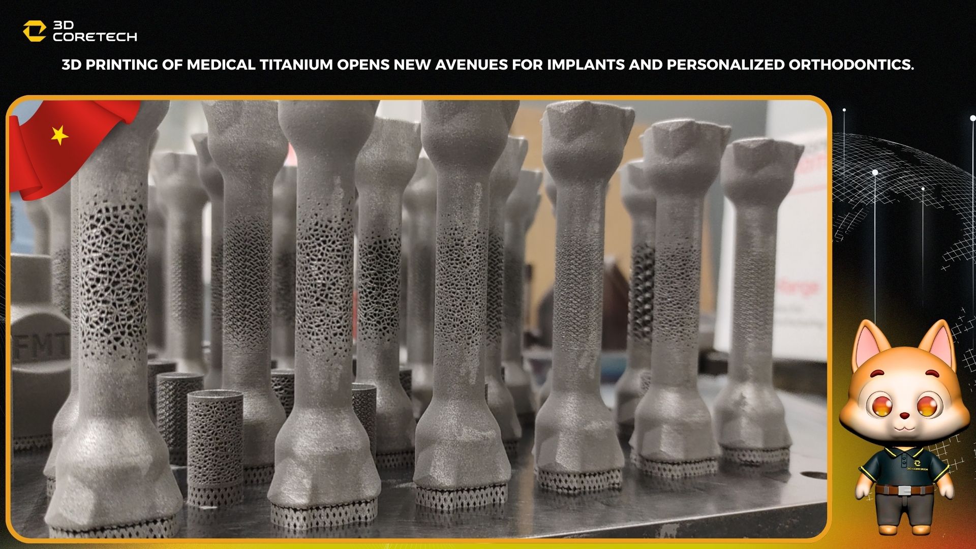 In 3D titan y tế mở ra hướng mới cho implant và chỉnh hình cá nhân hóa